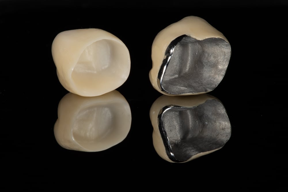 Tooth Crown