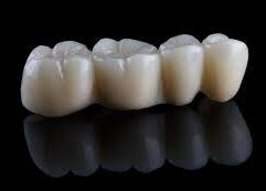Dental Bridges